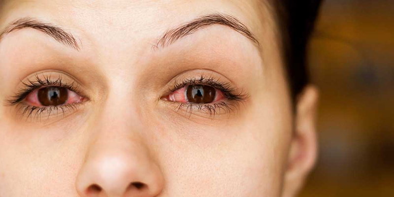 نشانه‌های حساسیت و آلودگی چشم چیست؟